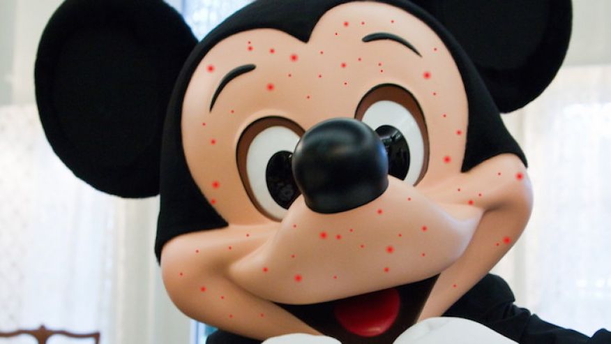 Mickey gets the Measles!